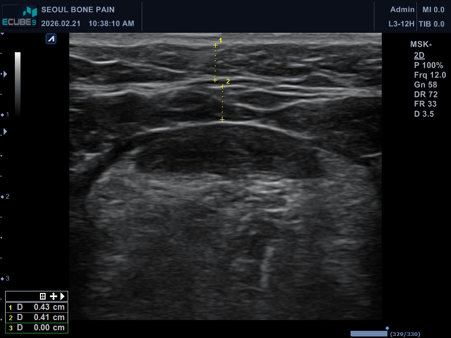 김단비 초음파.jpg